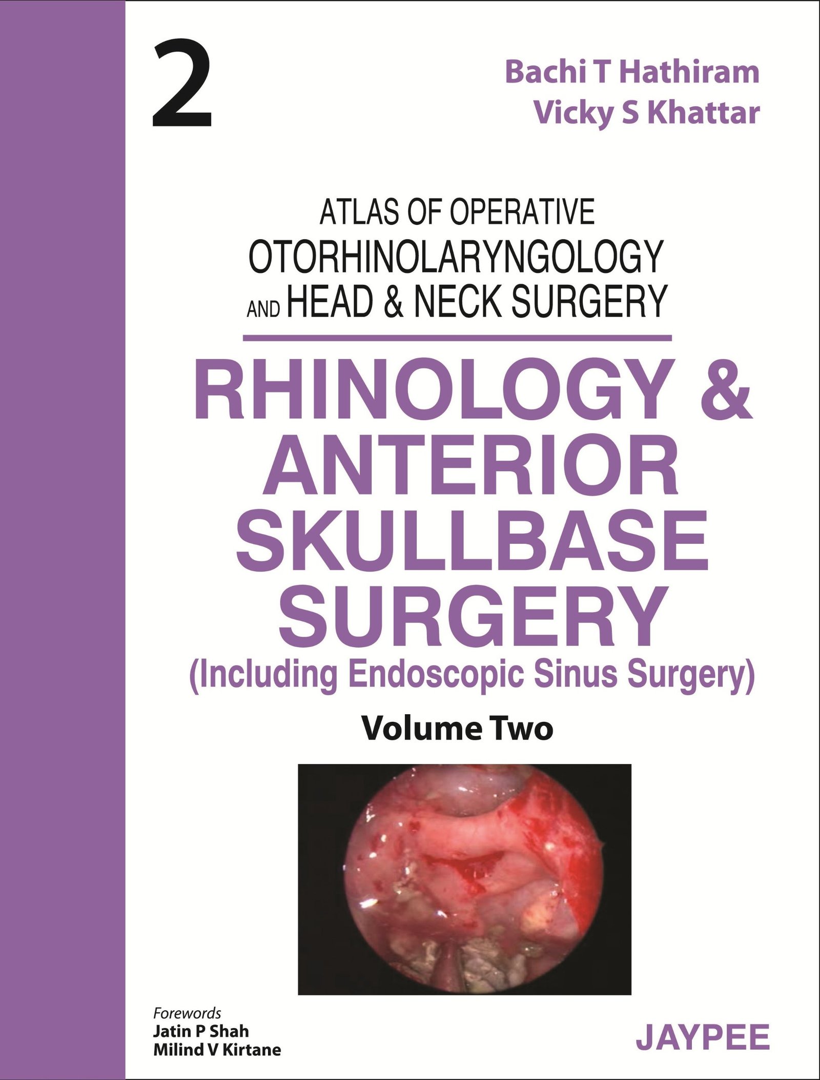 Rhinology and Anterior Skullbase Surgery Relié – 31 mars 2013 Édition en Anglais de Bachi T Hathiram (Auteur), Vicky S Khattar (Auteur)