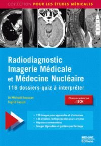 MED-LINE RADIODIAGNOSTIC IMAGERIE MEDICALE et médecine nucléaire : 116 dossiers-quiz à interpréter